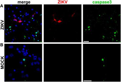 Zika Virus Promotes Neuronal Cell Death in a Non-Cell Autonomous Manner by Triggering the Release of Neurotoxic Factors